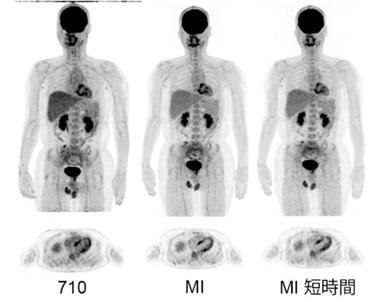 図PET3　710、MIで撮像した画像 MI短時間撮影は、全身を6分相当で撮像。