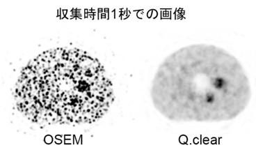 図PET4　MIにて1秒で収集したファントーム画像。 Q. Clearでの画像再構成法は優れている。