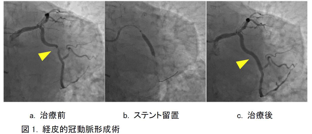 タイトルなし.png