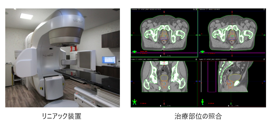 放射線治療科_図2.png