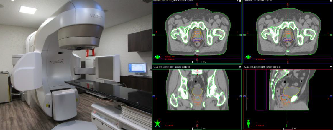 Xray2.png
