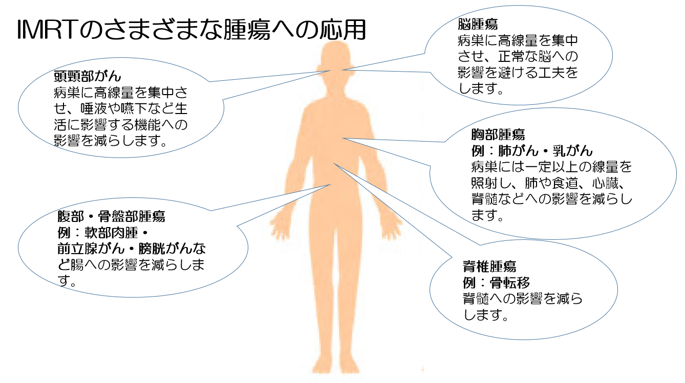 照射線量