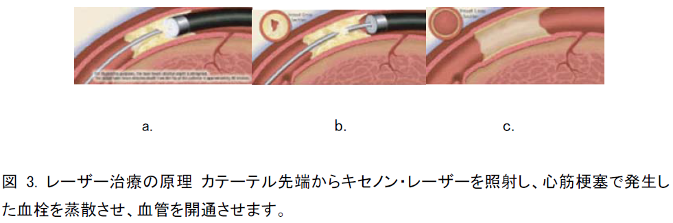 図3.png