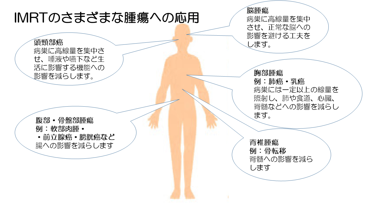 放射線治療科_図4.png