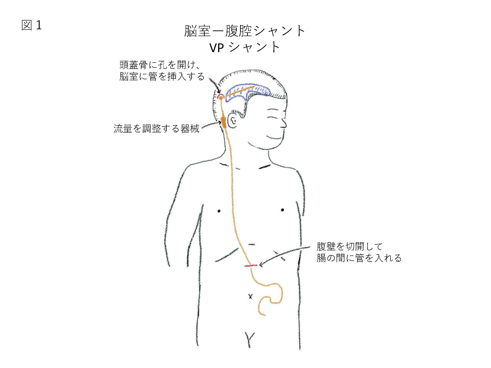 図1.jpg