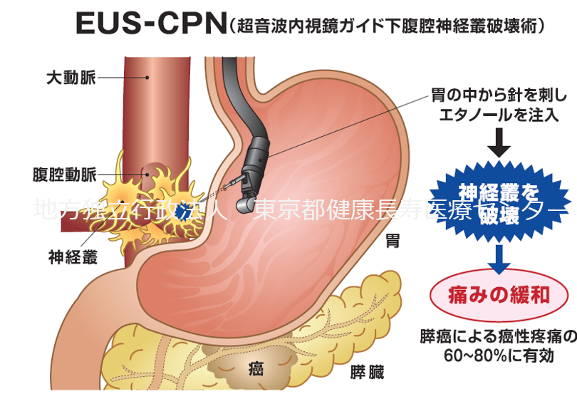 消化器 内視鏡内科 診療科情報 地方独立行政法人 東京都健康長寿医療センター