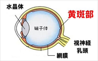 加齢黄斑変性とは