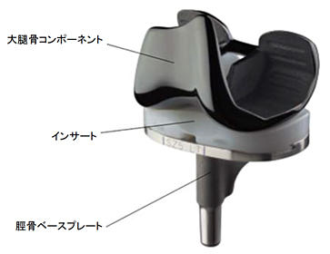 人工膝関節の各部品