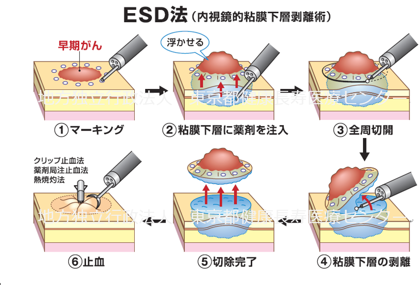 消化器内視鏡第29巻5号 ERCPのエキスパートを目指して 消化器内視鏡編集委員会