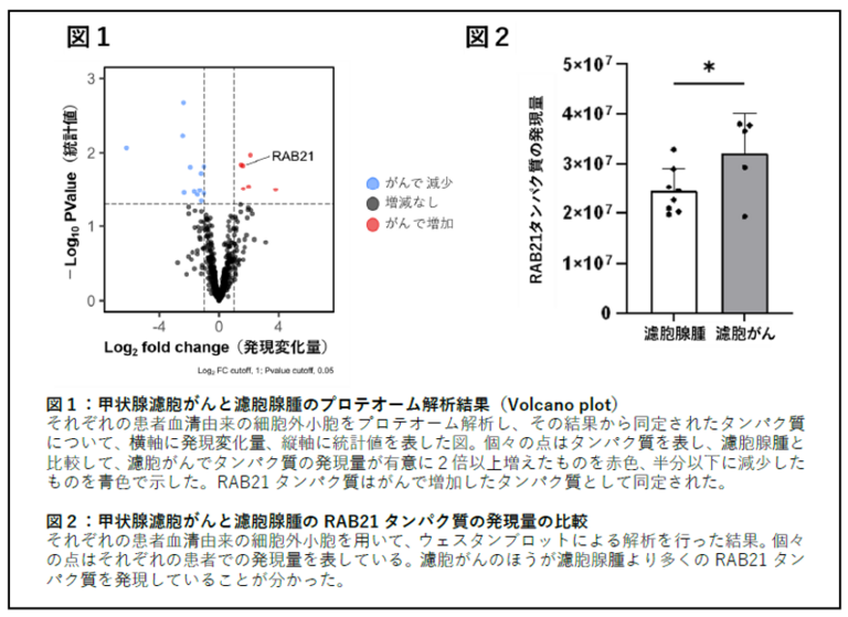 血液検査で甲状腺濾胞がんを見分ける新技術の開発～手術前診断の精度向上で患者負担を軽減～のサムネイル画像