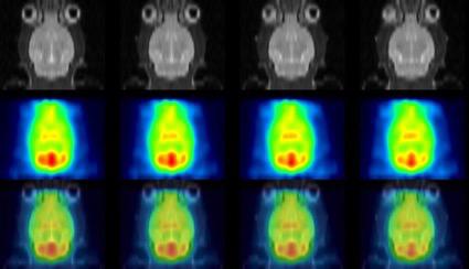 図1 小動物専用半導体PET装置と小動物専用MRIによる画像例