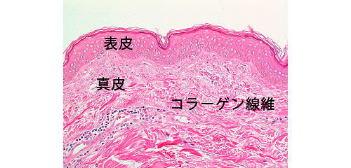 図２：日光に当たらない皮膚（腹部）の顕微鏡写真