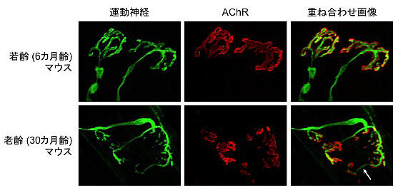 図3 : 加齢による神経筋シナプスの変化