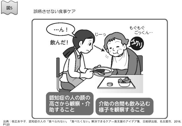 図5　誤嚥させない食事ケア