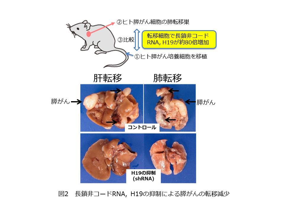 図2　長鎖非コードRNA, H19の抑制による膵がんの転移減少.JPG