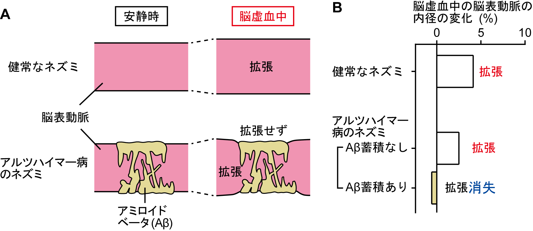 脳虚血_血管径_20230704.png